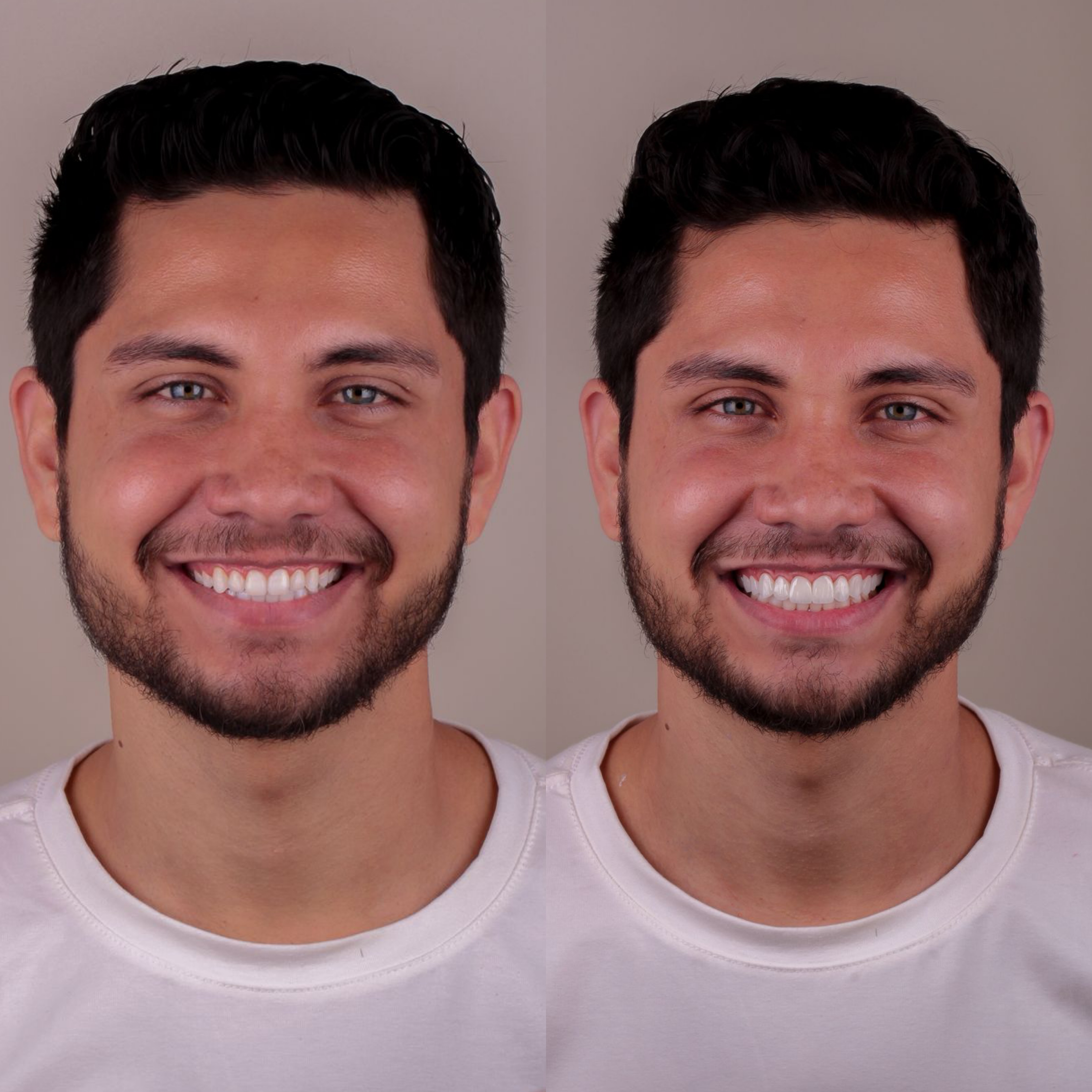 Resultado 2
